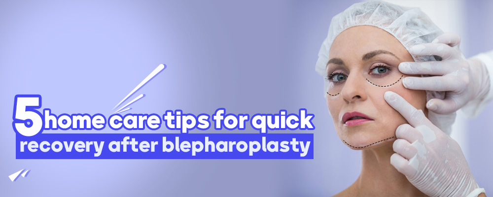 5 home care tips for quick recovery after blepharoplasty