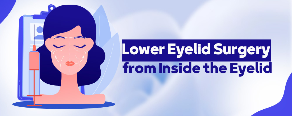 Lower Eyelid Surgery from Inside the Eyelid