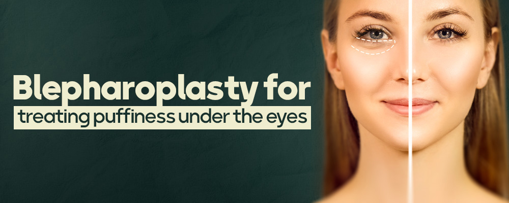 Blepharoplasty for treating puffiness under the eyes