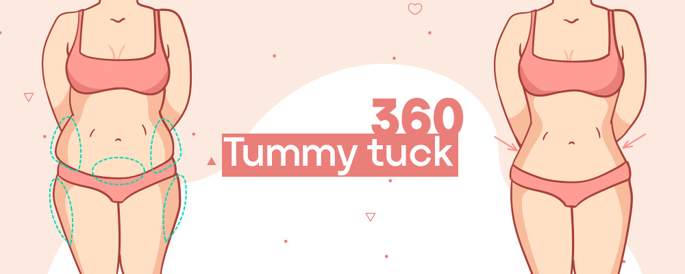 Tummy tuck 360