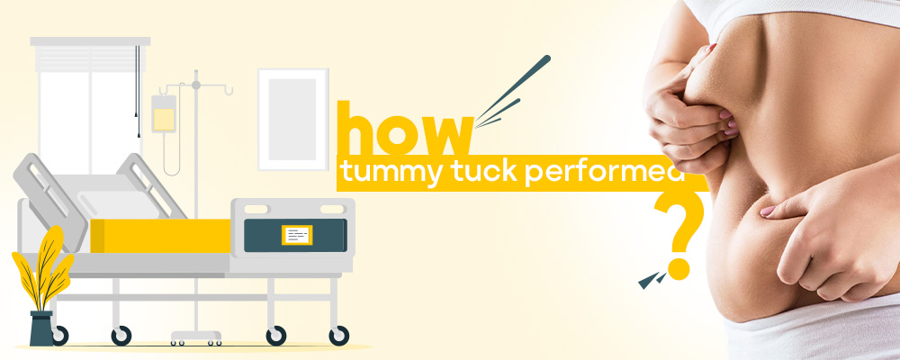 how tummy tuck performed?