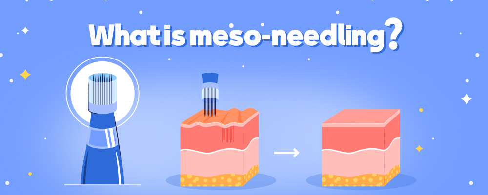 what is meso-needling?