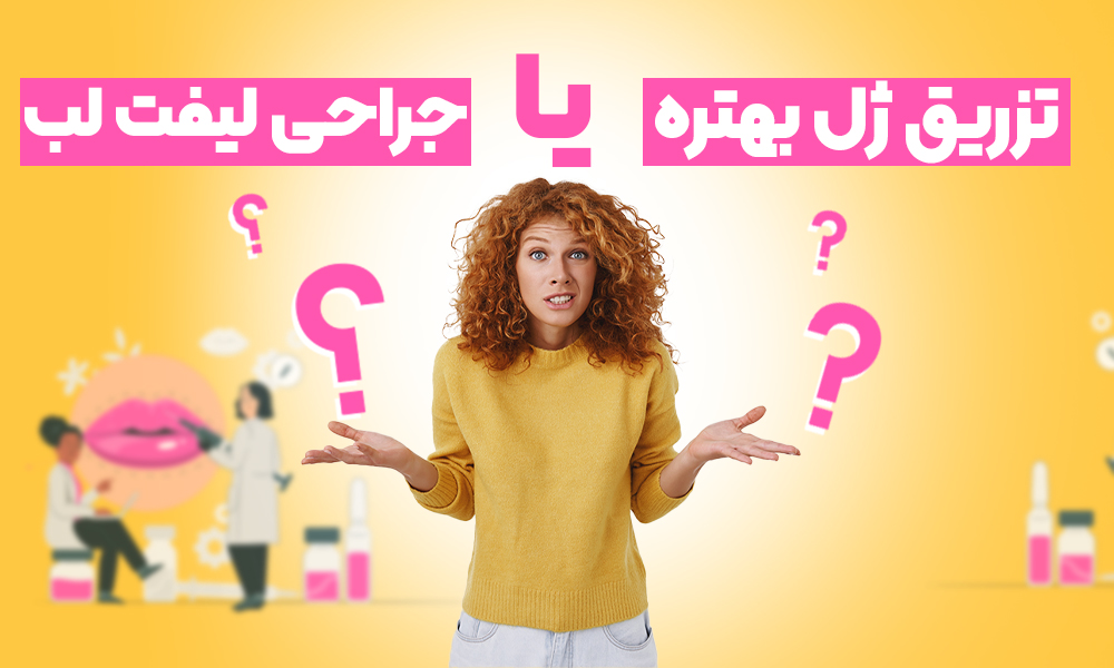 تزریق ژل بهتره یا جراحی لیفت لب؟!