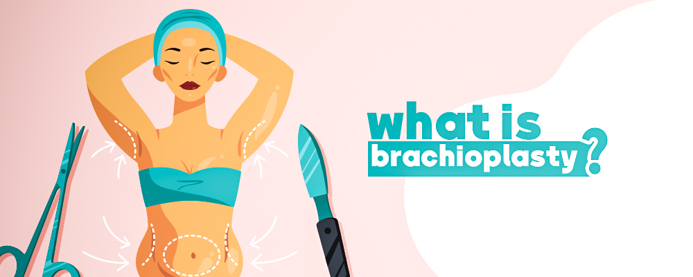 what is brachioplasty?